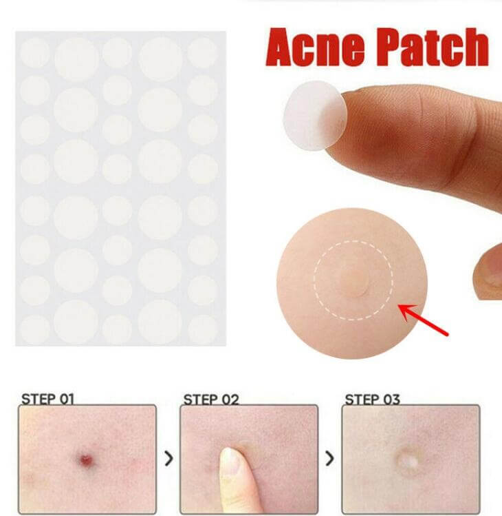 acne patch trustlab